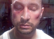 Fight injury makeup